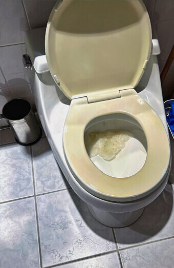 https://blockeddrainshuntingdale.com.au/uploads/2025/07/blocked-toilet-27293.jpg